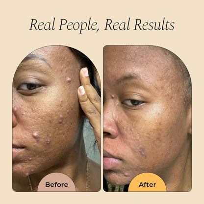 Turmeric Foaming Face Wash🌟Restore the radiance of the skin